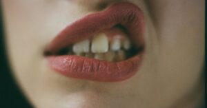 woman's lips and teeth